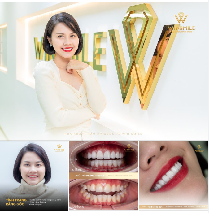 NÂNG CẤP PHIÊN BẢN HOÀN HẢO HƠN CỦA CHÍNH MÌNH