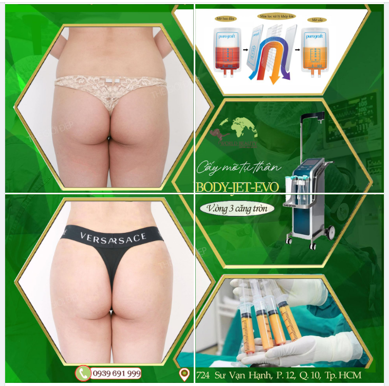 Làm đẹp bằng mỡ tự thân được xem là giải pháp An toàn vượt trội, hiệu quả cao phải kể đến sự góp mặt của hệ thống lọc mỡ Puregraft.