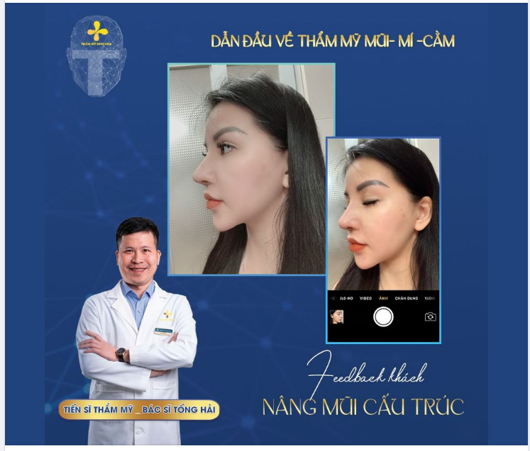 BẠN SẼ KHÔNG CẦN SỬ DỤNG APP CHỈNH ẢNH NỮA – CAM THƯỜNG CŨNG “CÂN” LUÔN