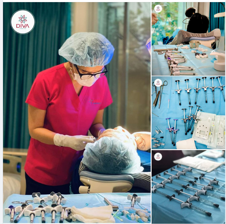 FILLER MD CODES – XÓA NỖI ÁM ẢNH CHẢY XỆ DA CỦA PHÁI ĐẸP