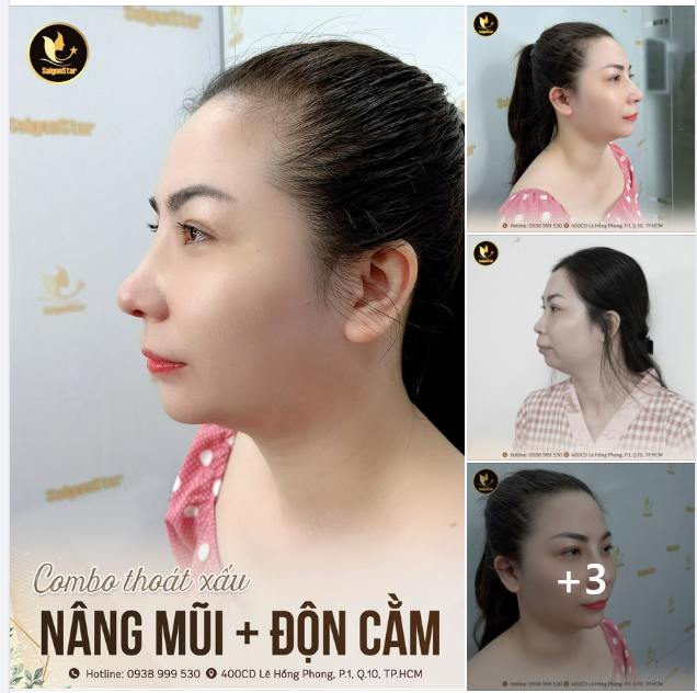 COMBO “THOÁT XẤU” CÙNG DR. HOẠT