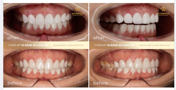 CHỈ 1 THAY ĐỔI NHỎ CŨNG MANG LẠI KHÁC BIỆT LỚN