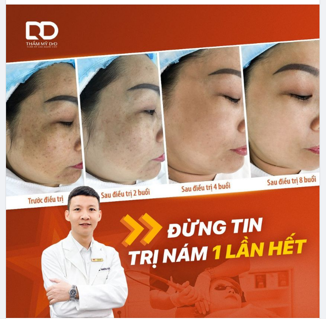 ĐỪNG TIN TRỊ NÁM 1 LẦN HẾT