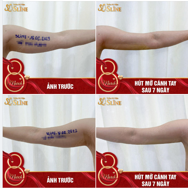 TAY THON, GỌN GÀNG THÌ CHÀNG MỚI MÊ