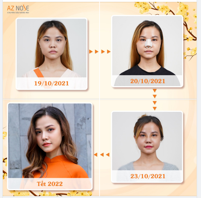 Rạng rỡ "như hoa mùa xuân" với dáng mũi 2 tháng tuổi