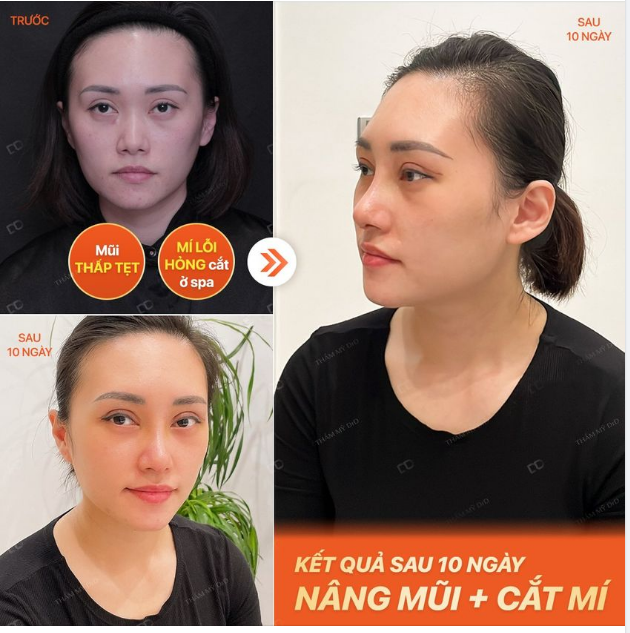 ĐẦU TƯ 60 PHÚT CÓ NGAY GƯƠNG MẶT SẮC NÉT TRƯỚC THỰC HIỆN: