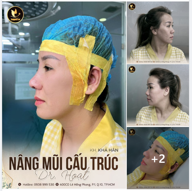 ĐẦU MŨI NGẮN HẾCH GÓC MŨI TRÁN THẤP VÕNG DÁNG MŨI NGẮN