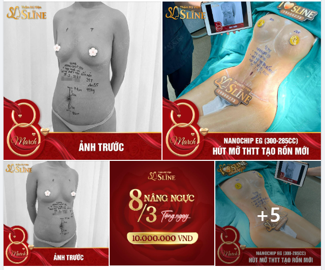 THOÁT CẢNH “ÉO LE” CHỖ THỪA CHỖ THIẾU
