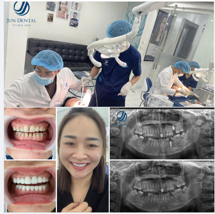 CÔNG CUỘC KIẾN TẠO NỤ CƯỜI