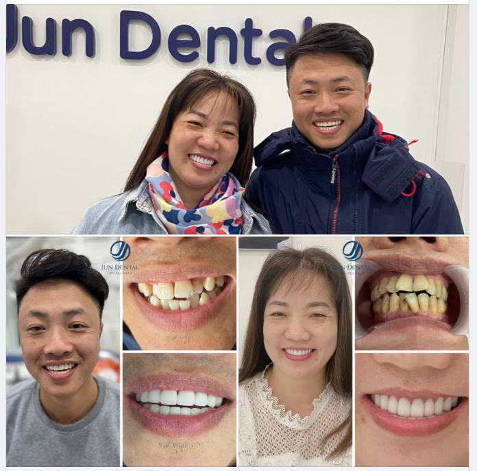 ĐÓN CHÀO 2 NỤ CƯỜI MỚI TRONG NGÀY THỨ 7 ĐẦU TIÊN KHAI XUÂN TẠI JUN DENTAL