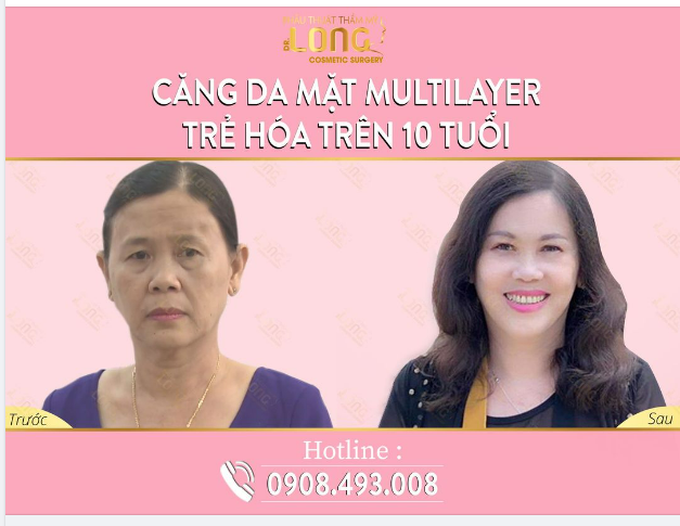 NHAN SẮC ĐỔI THAY CHỈ NHỜ CHĂM LÀM ĐIỀU NÀY MỖI NGÀY NẾU BẠN MUỐN NHẬN VỀ LÀN DA TRẺ LẠI QUA TỪNG NGÀY