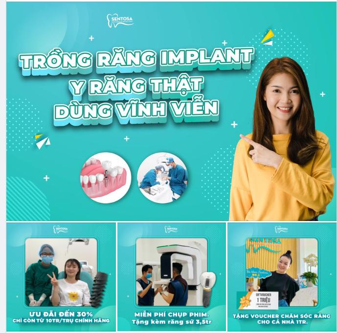 TRỒNG RĂNG IMPLANT - Y RĂNG THẬT - DÙNG VĨNH VIỄN