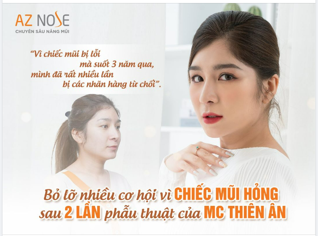Sự nghiệp MC bị “chững” lại chỉ vì dáng mũi bị “lỗi”...