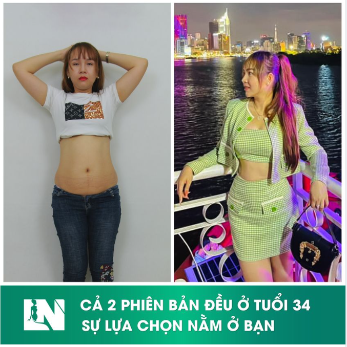 TRỞ THÀNH PHIÊN BẢN NHƯ THẾ NÀO – LỰA CHỌN NẰM Ở BẠN!