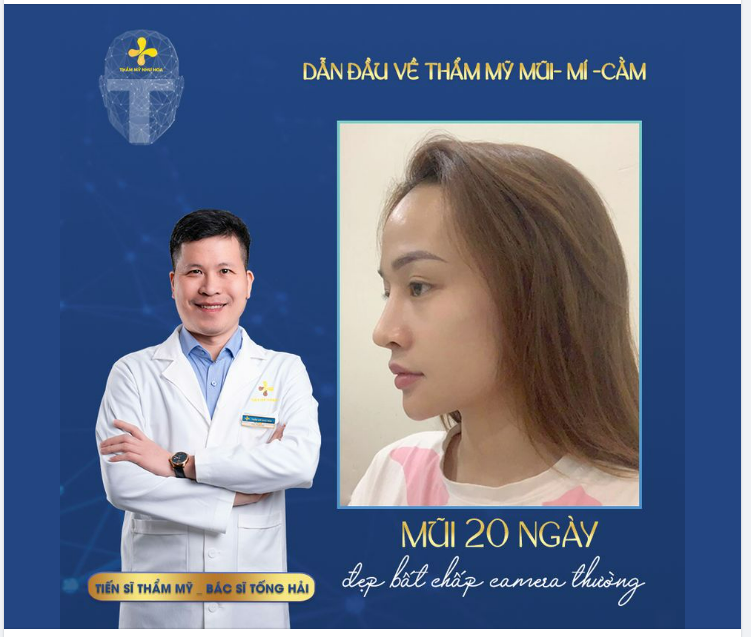 NÂNG MŨI ​​​​​​​20 NGÀY - ĐẸP BẤT CHẤP CAMERA THƯỜNG