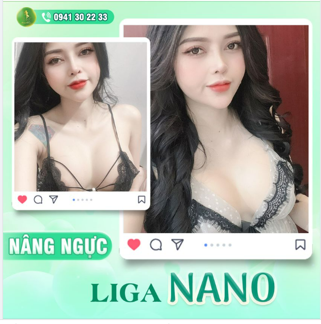 V1 HOÀN HẢO THU HÚT MỌI ÁNH NHÌN