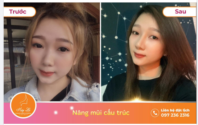 Tỏa sáng mọi khung hình nhờ dáng Mũi thanh thoát – tự nhiên