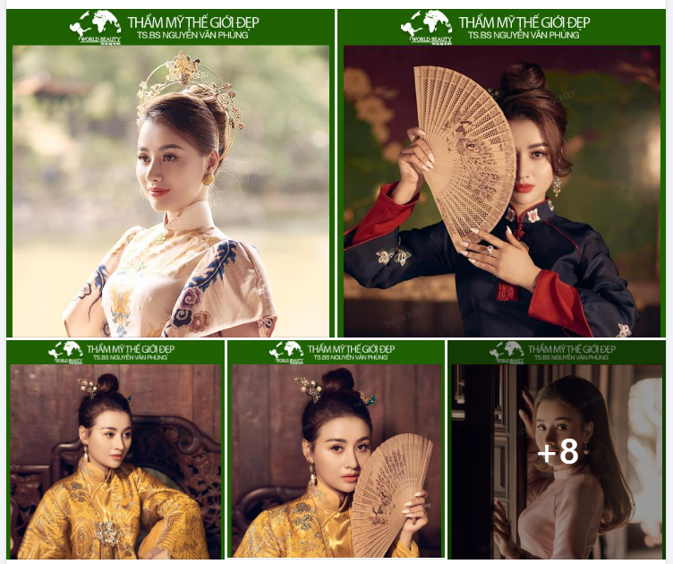Mê mẩn với nét đẹp trang đài, đằm thắm cùng Huế xưa của quý cô trong cổ phục hoàng cung sau 2 năm nâng mũi