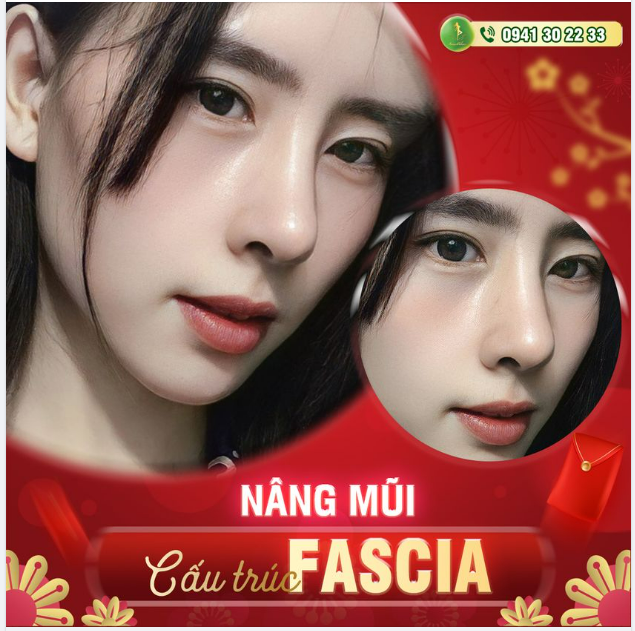 CÔ NÀNG HOA THỊ LỘT XÁC THÀNH HOTGIRL SAU NÂNG MŨI