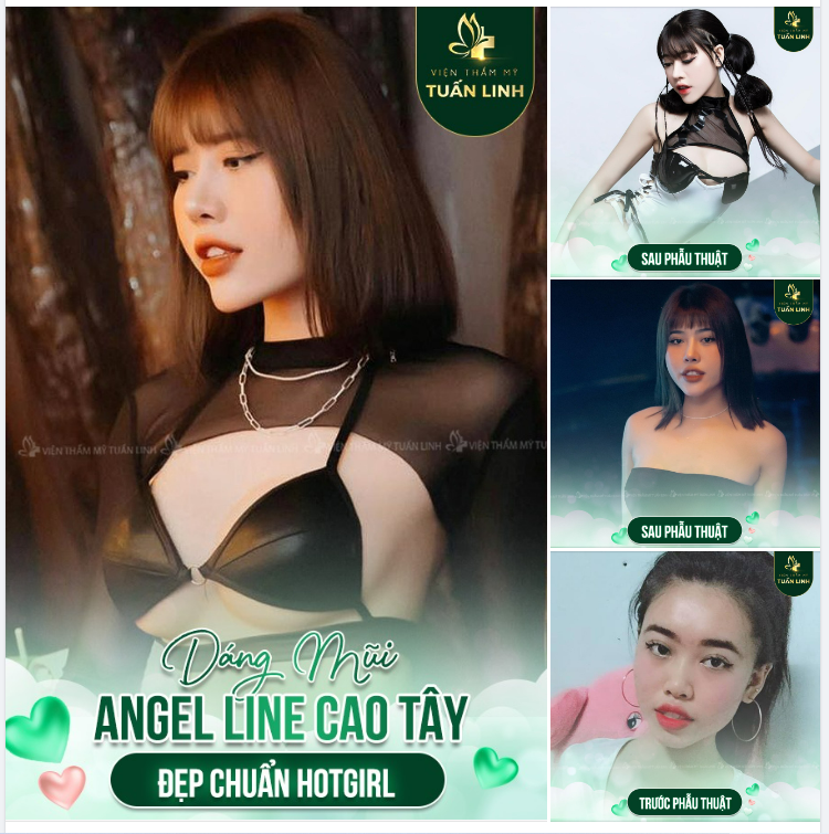 Dáng mũi Angel Line cao tây - Đẹp chuẩn Hotgirl cho cô nàng cá tính 
