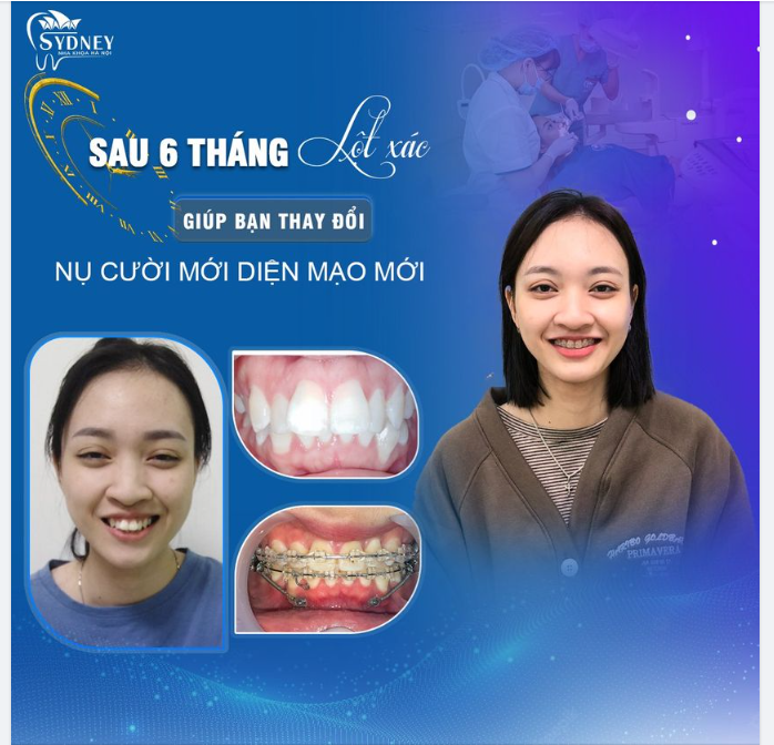 Ưu đãi cực lớn mùa Valentine