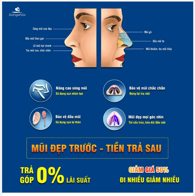 NÂNG MŨI TRẢ GÓP - HỖ TRỢ BẠN TÀI CHÍNH ĐỂ BẠN ĐẸP HƠN
