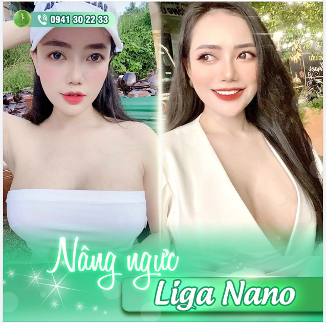 PHƯƠNG NGA "ĐỐT MẮT" VỚI V1 LIGA NANO ĐẾN TỪ SAIGON VENUS