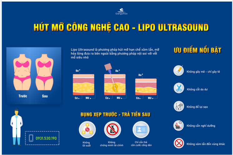 BẠN ĐÃ BIẾT ĐẾN HÚT MỠ CÔNG NGHỆ CAO - LIPO ULTRASOUND CHƯA?