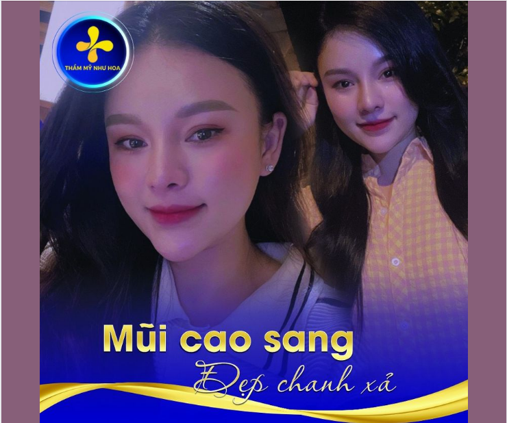 Mũi cao sang – chuẩn tỷ lệ vàng