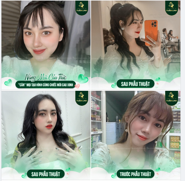 ''CÂN'' MỌI TẠO HÌNH VỚI CHIẾC MŨI CAO XINH!