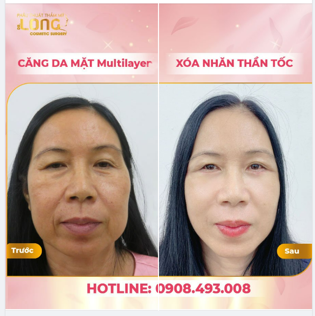 TÁI SINH DA CŨ - ĐỔI DA MỚI - LỜI HỒI ĐÁP CHO LÀN DA