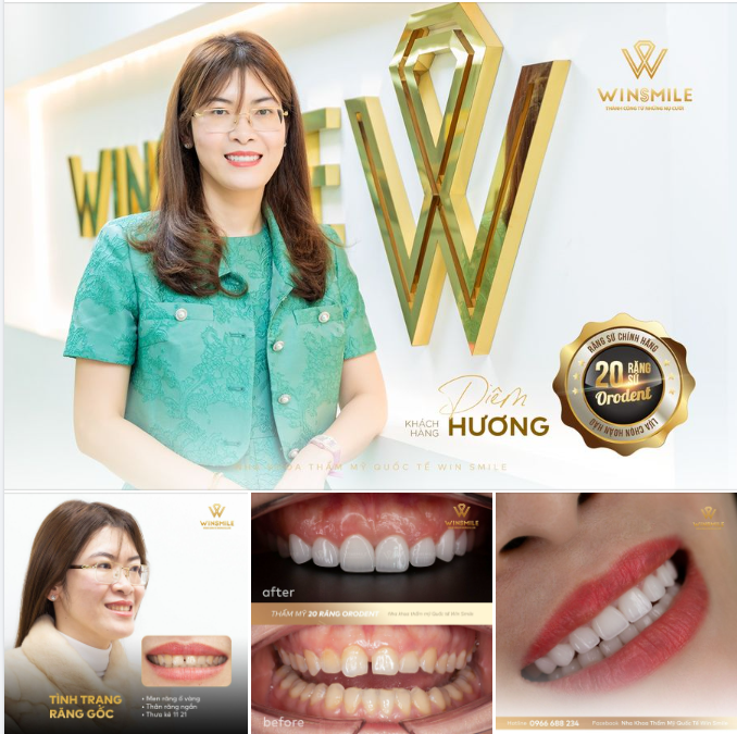 RĂNG SỨ KHÔNG CHỈ LÀ LỚP ÁO MỚI LÀM ĐẸP MÀ CÒN BẢO VỆ SỨC KHỎE RĂNG MIỆNG SUỐT CUỘC ĐỜI