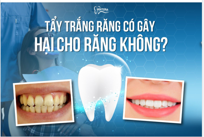 TẨY TRẮNG RĂNG CÓ GÂY HẠI CHO RĂNG