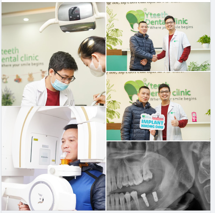 Lựa chọn trồng răng implant sau 20 năm mất răng.