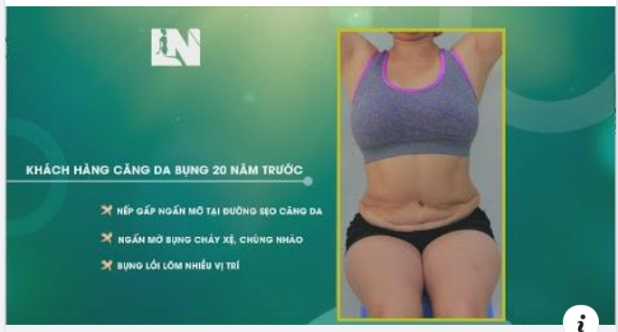 Tâm niệm: “Làm đẹp là phải ĐẸP và AN TOÀN”, Bác sĩ Lương Ngọc chỉ thực hiện khám bệnh, chữa bệnh và phẫu thuật thẩm mỹ tại Bệnh viện đạt chuẩn Bộ Y Tế.