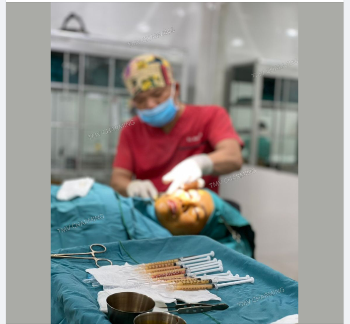 GƯƠNG MẶT ĐẦY ĐẶN, TRẺ TRUNG HƠN NHỜ PHƯƠNG PHÁP CẤY RÃNH MŨI MÁ