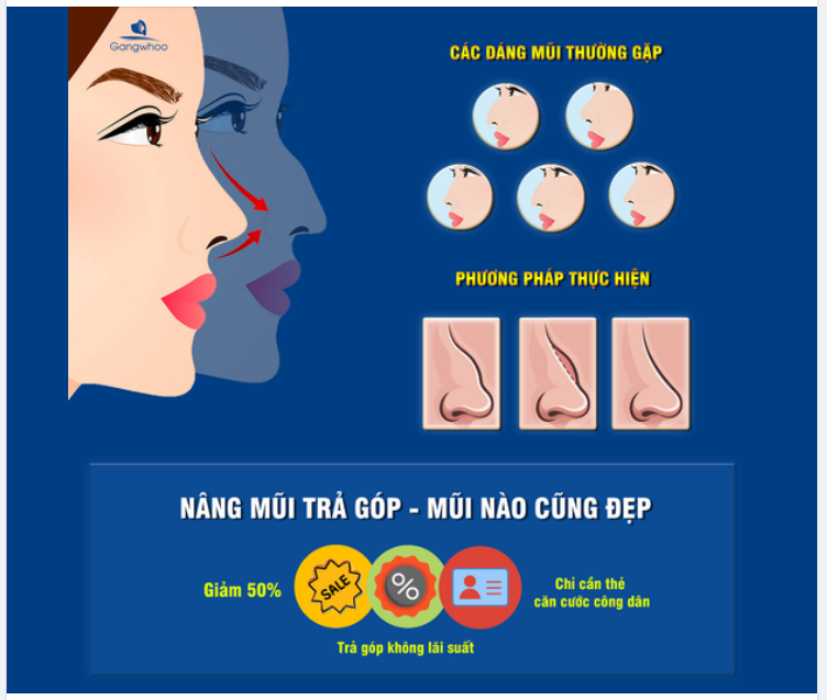 NÂNG MŨI TRẢ GÓP - MŨI NÀO CŨNG ĐẸP