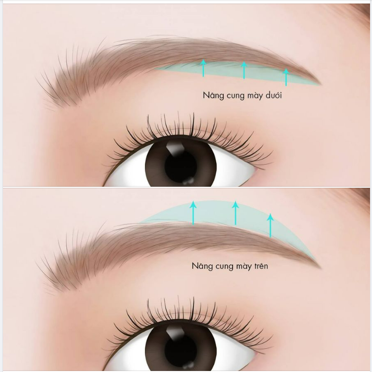 LẤY LẠI TUỔI XUÂN CHO ĐÔI MẮT BẰNG CÁCH NÂNG CUNG MÀY