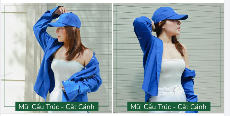 Mái tóc dễ thương, trang phục năng động, chiếc mũi vừa nâng cấu trúc, cắt cánh tròn 1 tháng thì lại quyến rũ.
