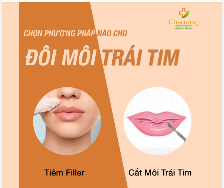 MUỐN CÓ ĐÔI MÔI TRÁI TIM QUYẾN RŨ - NÊN TIÊM FILLER HAY PHẪU THUẬT CẮT MÔI?