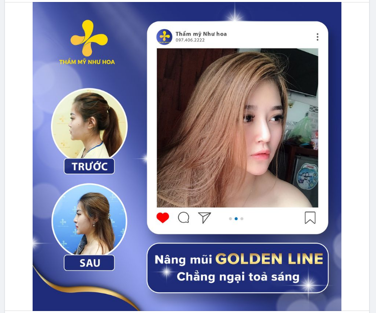 MŨI XINH - NHAN SẮC THÊM LUNG LINH chỉ sau HƠN 1 TUẦN!