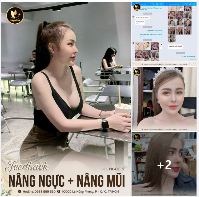 FEEDBACK COMBO NÂNG NGỰC + NÂNG MŨI