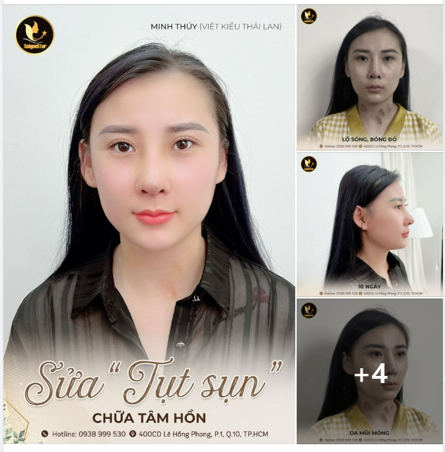 SỬA TỤT SỤN – CHỮA TÂM HỒN