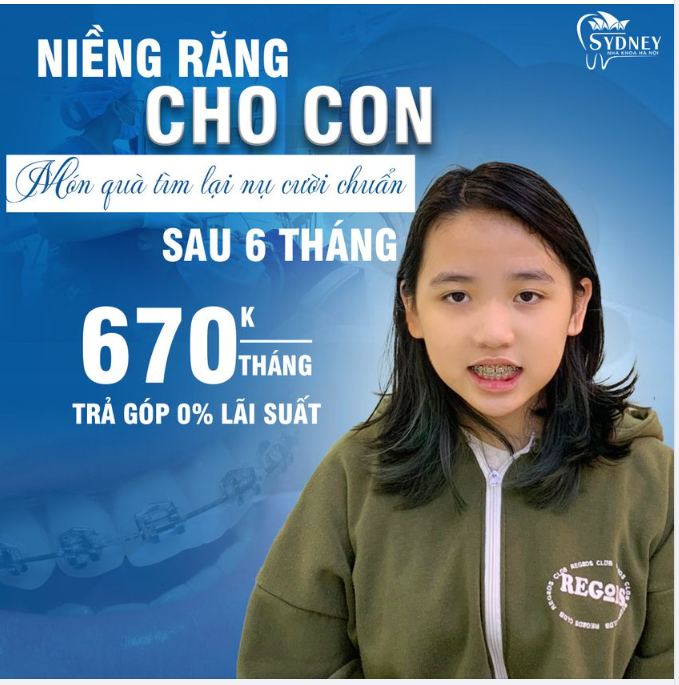 Niềng răng cho con  Bố mẹ đầu tư sớm – Con tự tin sớm