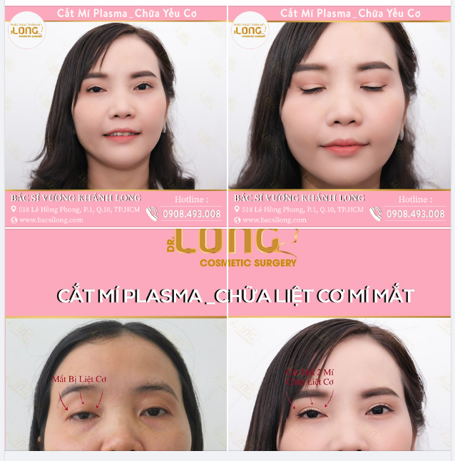 MỞ MẮT “ĐÔI” - NẮM BẮT TƯƠNG LAI
