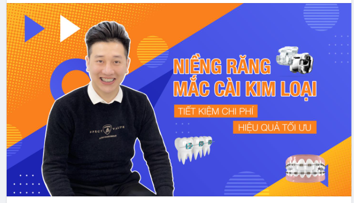 NIỀNG RĂNG MẮC CÀI KIM LOẠI TIẾT KIỆM CHI PHÍ - HIỆU QUẢ TỐI ƯU !