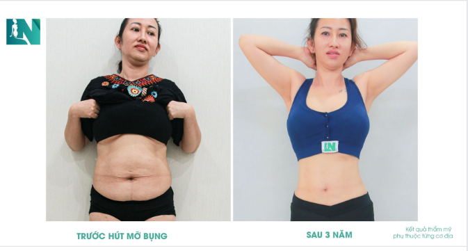 GIỮ VÒNG EO CON KIẾN SAU HƠN 3 NĂM GIẢM MỠ, CÓ THẬT KHÔNG?