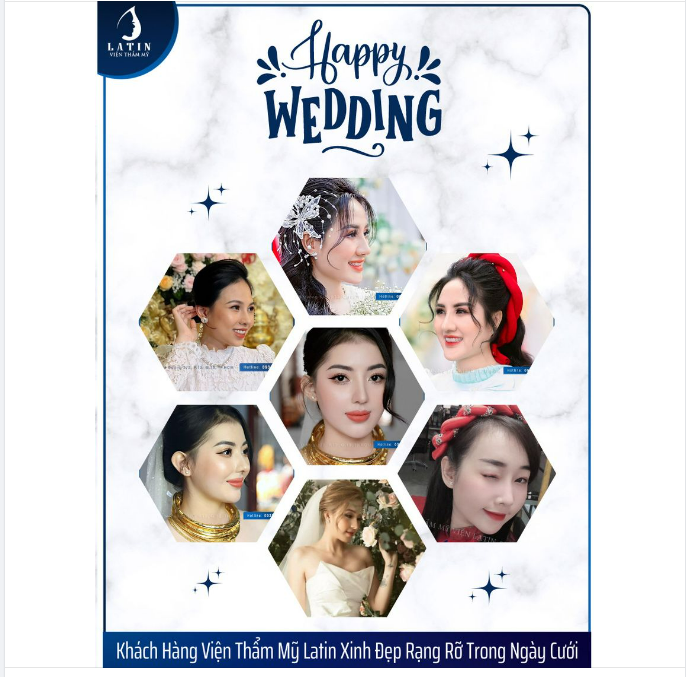 Nâng mũi phong thủy tại Latin - Thay tướng đổi vận: Sự nghiệp - tiền tài - tình duyên hưng thịnh, giúp cho đời sống của khách hàng thêm phần viên mãn.