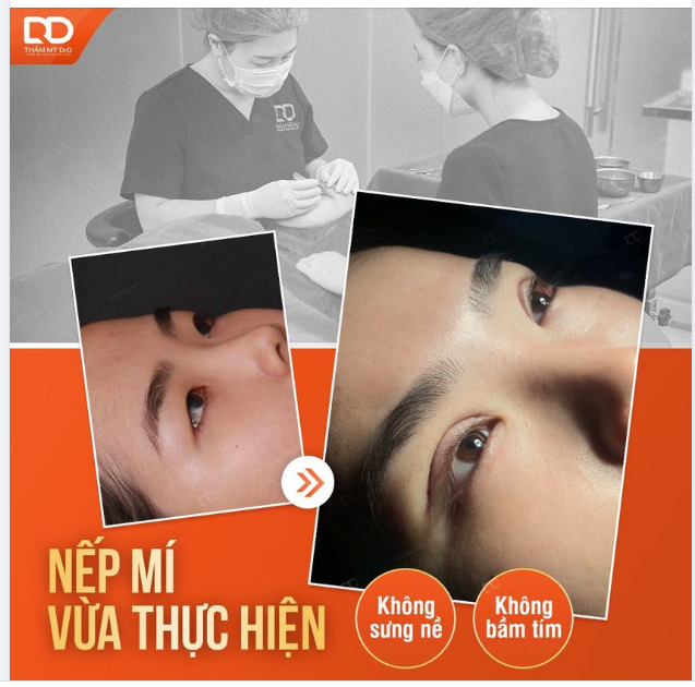ĐẾM NGƯỢC 7 NGÀY HỒI PHỤC SAU CẮT MÍ KỊP TẾT NGUYÊN ĐÁN