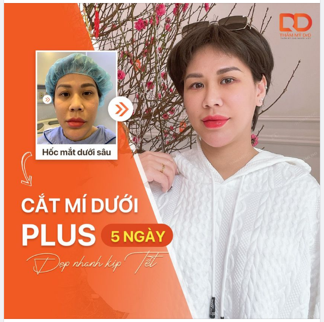 Biết ông Thương không? Thương nào? Thương cho tấm thân này không biết đến CẮT MÍ PLUS sớm hơn